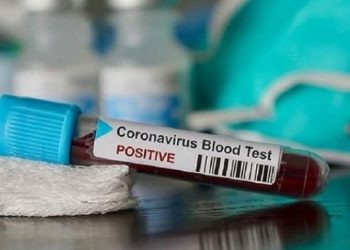 Wabah Corona di Indonesia Kian Meluas, Jumlah Pasien Capai 309 Orang, 29 Meninggal