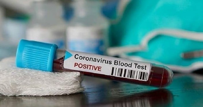 Wabah Corona di Indonesia Kian Meluas, Jumlah Pasien Capai 309 Orang, 29 Meninggal