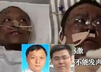 Terinfeksi Covid-19, Dua Dokter di China Berubah Menghitam