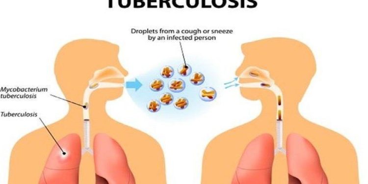 Tuberkulosis Mengancam Generasi di Asia Pasifik