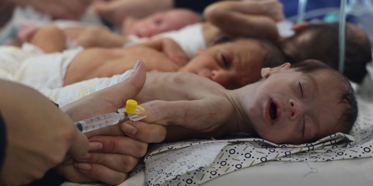 Babies in Gaza Slowly Perishing Under the World’s Gaze
