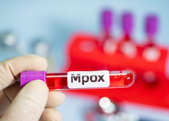 MPOX Outbreak in Conflict-Torn African State Raises UN Concerns