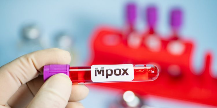 MPOX Outbreak in Conflict-Torn African State Raises UN Concerns