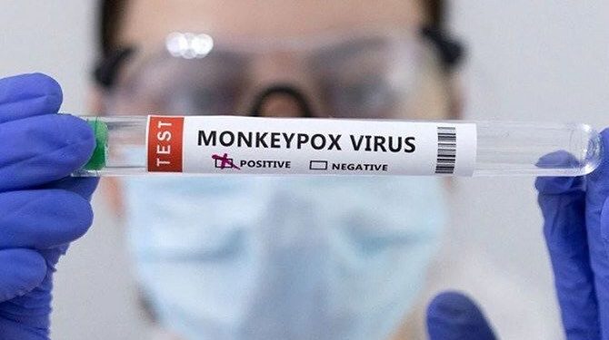 Pandemic Fund Prepares US$128.89 Million to Treat Mpox in 10 Countries