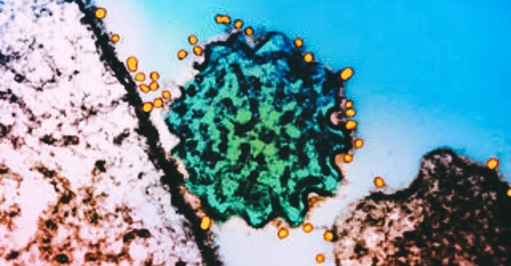 Asia on Edge: Nipah Outbreak in India Triggers Regional Airport Alerts