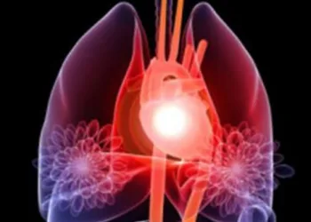 Normal Cholesterol Isn’t Enough: Prodia’s Advanced Lipid Test Exposes Hidden Heart Risks