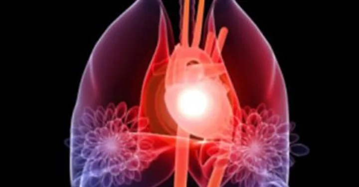 Normal Cholesterol Isn’t Enough: Prodia’s Advanced Lipid Test Exposes Hidden Heart Risks